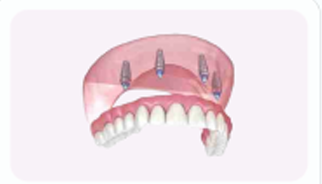 tooth_images
